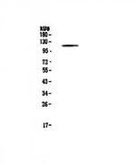 PMS2 Polyclonal Antibody