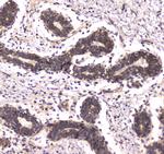 POLR2A Polyclonal Antibody