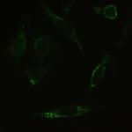 MYPT1 Antibody in Immunocytochemistry (ICC/IF)