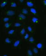 CPI-17 Polyclonal Antibody