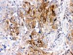 DARPP-32 Polyclonal Antibody