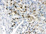 PPT1 Polyclonal Antibody