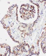 PRDX5 Polyclonal Antibody