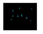 PRDX5 Polyclonal Antibody