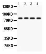 PKC eta Polyclonal Antibody