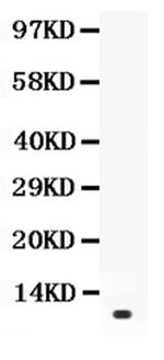 Prolactin Antibody in Western Blot (WB)