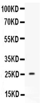 Prolactin Polyclonal Antibody