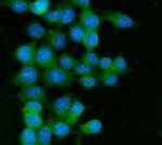 RAB13 Polyclonal Antibody