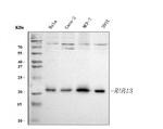 RAB13 Antibody in Western Blot (WB)