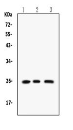 RAB14 Polyclonal Antibody