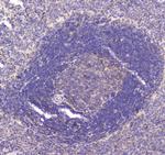 RAB27A Antibody in Immunohistochemistry (Paraffin) (IHC (P))