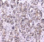 RAB27A Polyclonal Antibody