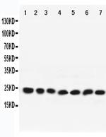 RAB9 Polyclonal Antibody