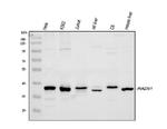 RAD51 Polyclonal Antibody