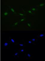 RAN Polyclonal Antibody