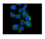 RASA1 Polyclonal Antibody