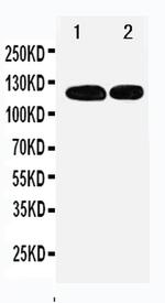 RBL1 Antibody in Western Blot (WB)