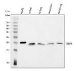 RBP4 Antibody in Western Blot (WB)