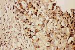 RFC1 Antibody in Immunohistochemistry (Paraffin) (IHC (P))