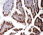 RGS3 Polyclonal Antibody