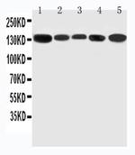 RGS3 Antibody in Western Blot (WB)