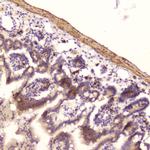 RNASE3 Polyclonal Antibody