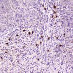 RNASE3 Antibody in Immunohistochemistry (Paraffin) (IHC (P))