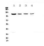 RPGR Antibody in Western Blot (WB)