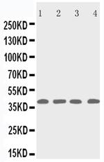 p53R2 Polyclonal Antibody