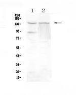 RTEL1 Polyclonal Antibody