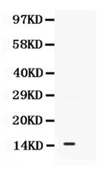 S100A11 Polyclonal Antibody