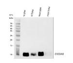 S100A8 Antibody in Western Blot (WB)