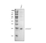 S100A9 Antibody in Western Blot (WB)