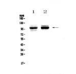 SATB1 Antibody in Western Blot (WB)