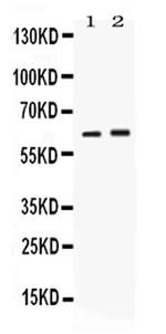 SCTR Polyclonal Antibody