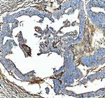 SDHA Antibody in Immunohistochemistry (Paraffin) (IHC (P))