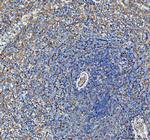 SDHA Antibody in Immunohistochemistry (Paraffin) (IHC (P))