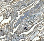 SDHA Antibody in Immunohistochemistry (Paraffin) (IHC (P))