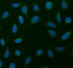 SDHA Polyclonal Antibody