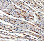 SDHA Antibody in Immunohistochemistry (Paraffin) (IHC (P))