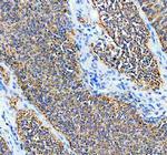 SDHA Antibody in Immunohistochemistry (Paraffin) (IHC (P))