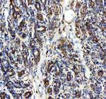 SDHA Antibody in Immunohistochemistry (Paraffin) (IHC (P))