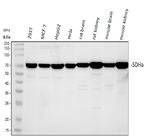 SDHA Antibody in Western Blot (WB)