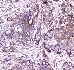 SDHB Antibody in Immunohistochemistry (Paraffin) (IHC (P))