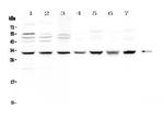 SDHB Antibody in Western Blot (WB)