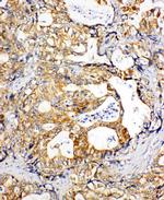 SDHC Polyclonal Antibody