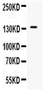 P-Selectin (CD62P) Antibody in Western Blot (WB)
