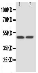 Kallistatin Antibody in Western Blot (WB)