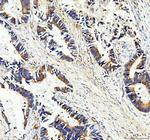 Maspin Antibody in Immunohistochemistry (Paraffin) (IHC (P))