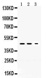 Neuroserpin Polyclonal Antibody